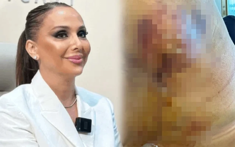 Həkim məni 3 dəfə əməliyyat edib pis vəziyyətə qoydu -  Daha bir məşhur cərrahdan ŞİKAYƏT