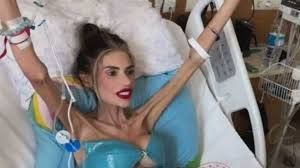  25 kiloya düşən Nihal Candan ölə bilər 