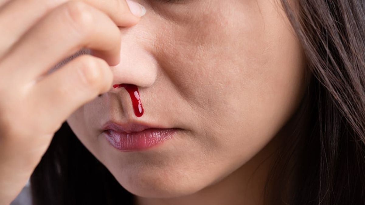 Ani burun qanamaları nəyi göstərir? -  Ən çox rast gəlinən səbəblər 