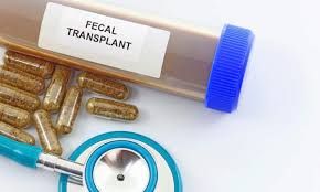 Nəcis transplantasiyası autizmi    müalicə edə bilər