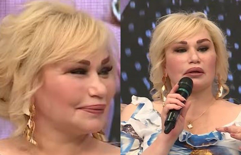 Daha bir müğənninin əməliyyatdan sonra    üzü əyildi