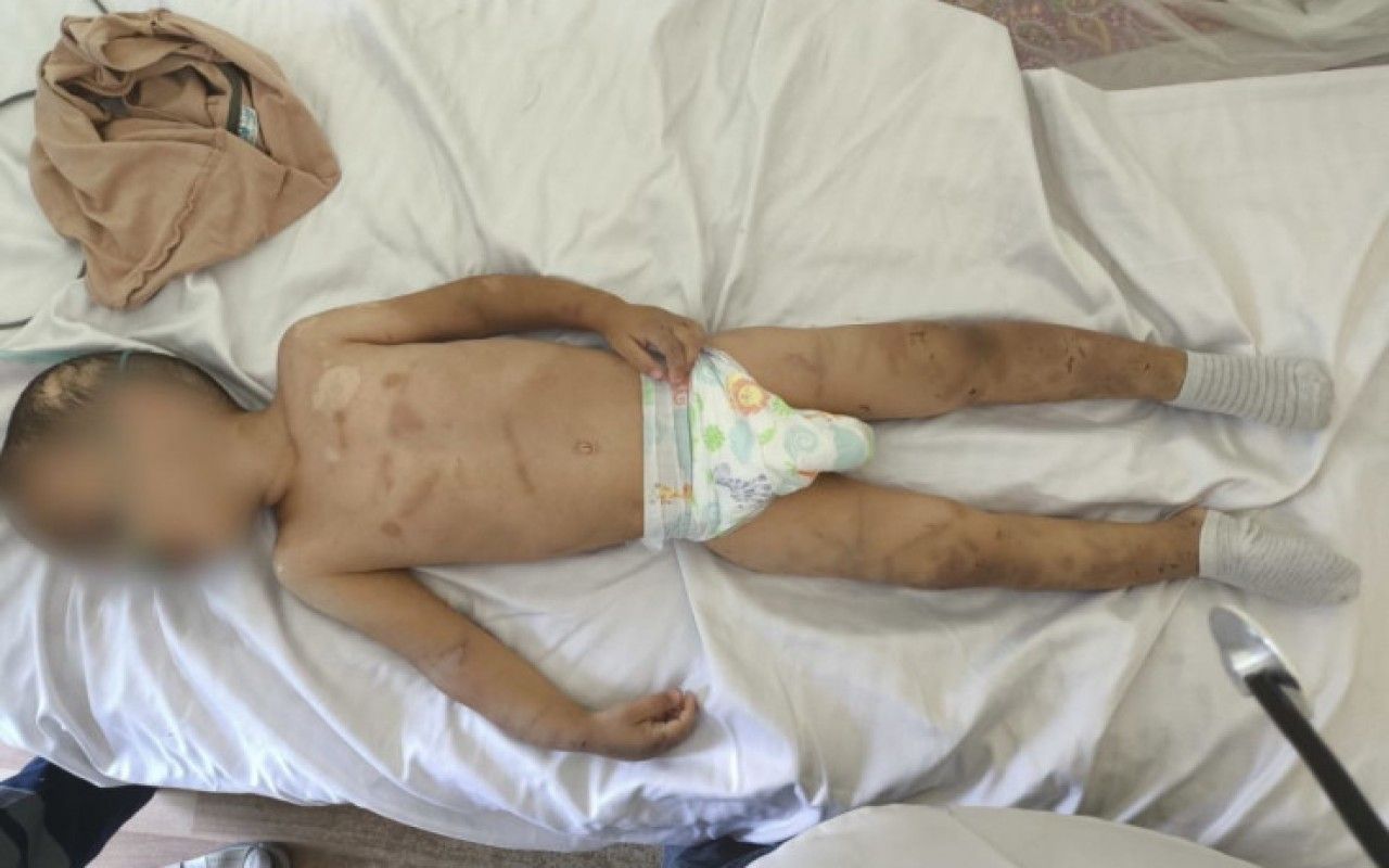 Ağdamda ata 2 yaşlı uşağını ölümcül döydü -  FOTO