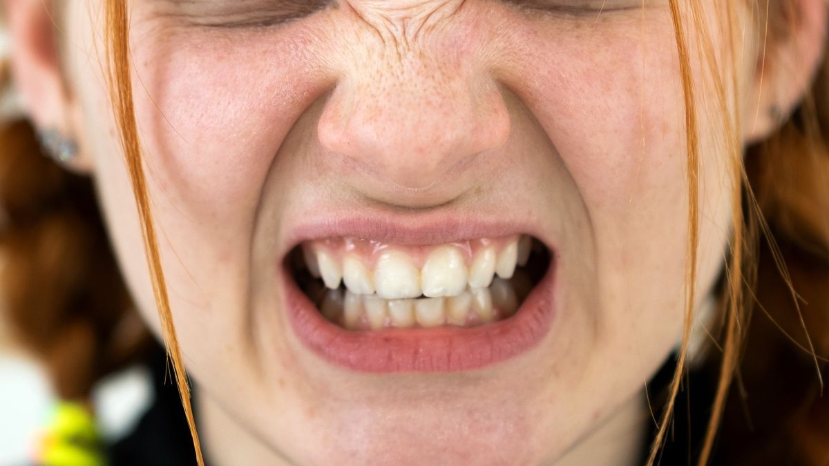 Dişlərinizi sıxmayın:  Miqrenə səbəb olur