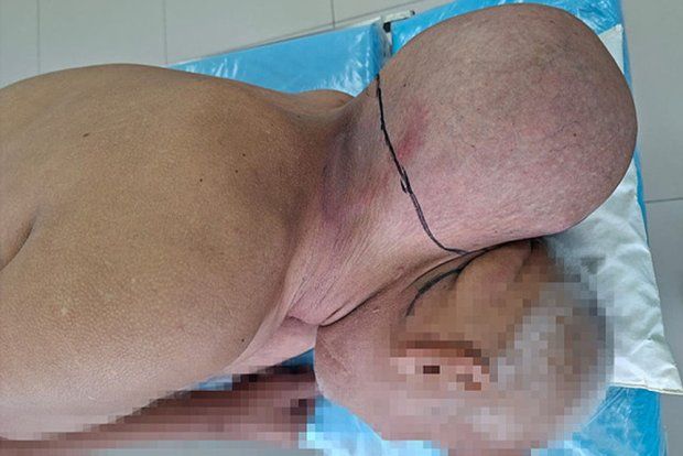 16 il boynundakı “ikinci” başla gəzdi  – Kuryoz olay
