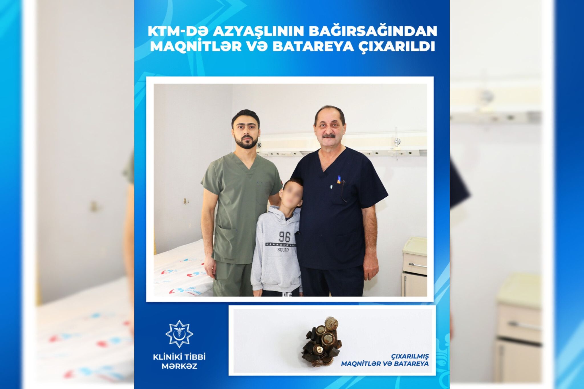 9 yaşlı uşağın bağırsağından bareya və maqnit qırıntıları çıxdı -  FOTO