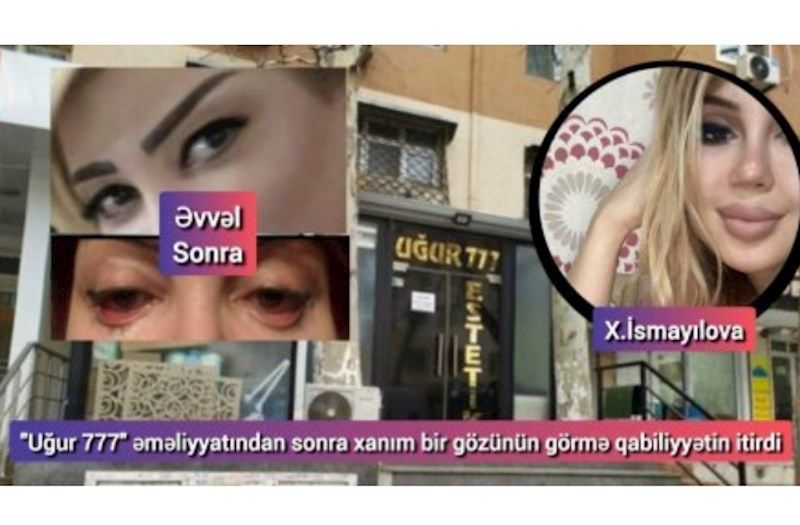 Daha bir saxta estetik həkim ifşa olundu 