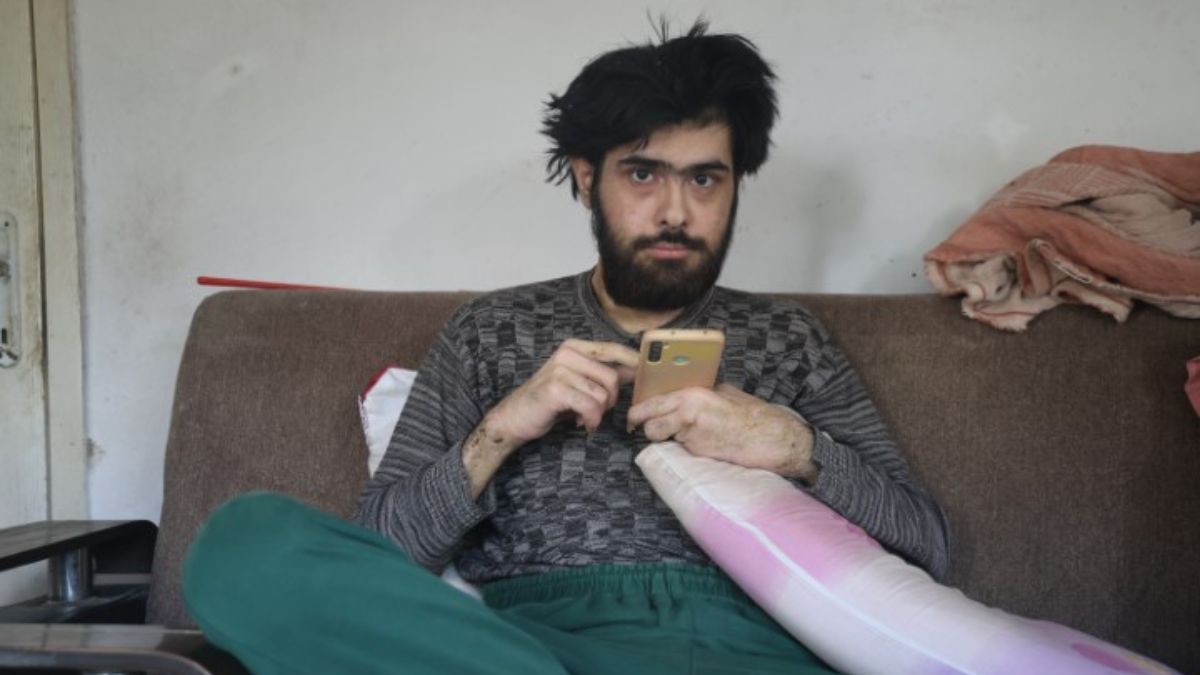 Üç ildir evdən çölə çıxmayan gənc hər kəsi şoka saldı -  FOTO 