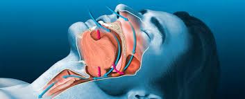  Tibdə ilk  - Xorultu xərçəng riski ilə əlaqələndirildi