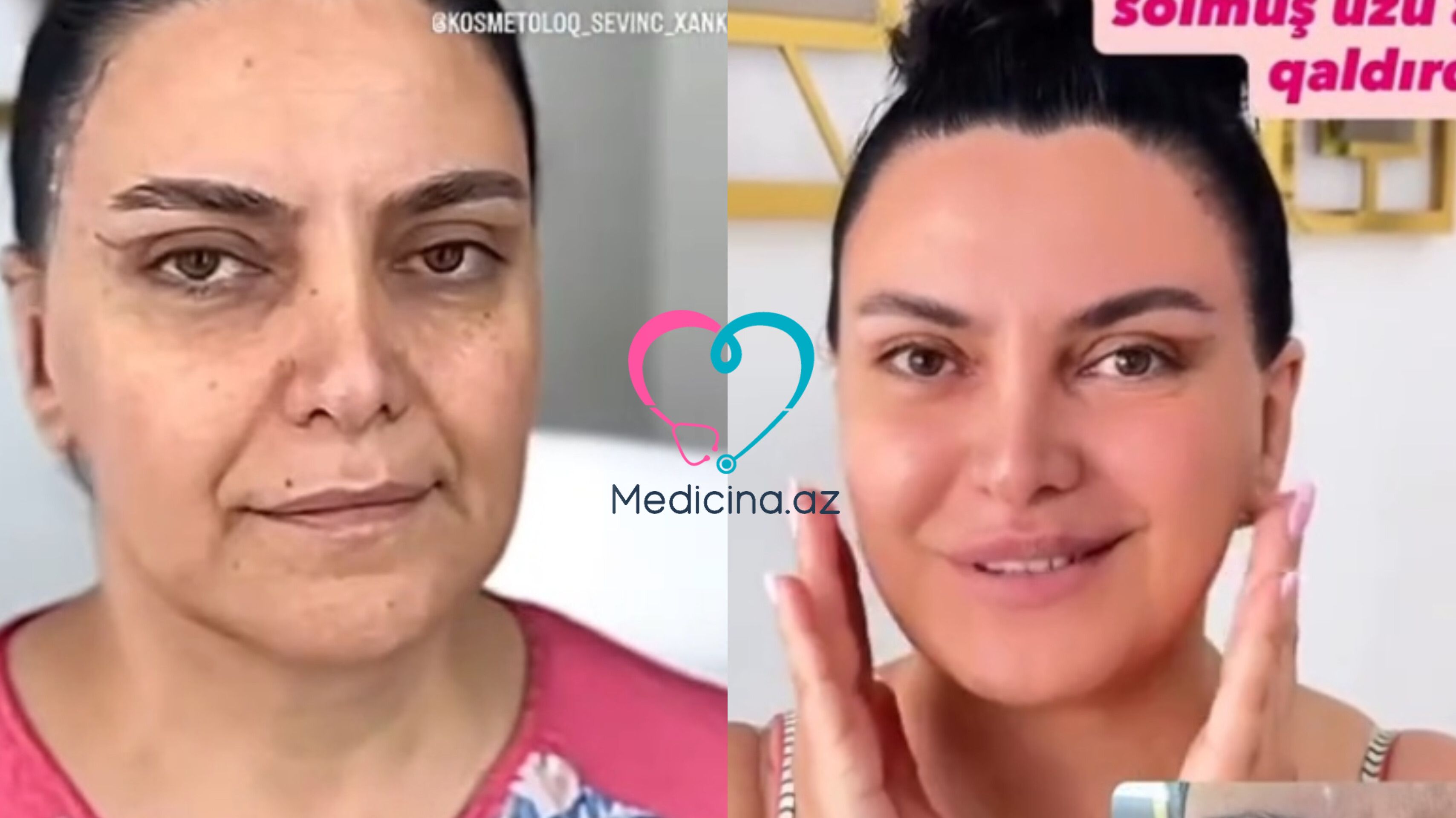 Bakıda qadının dəyişimi hamını şoka saldı -  VİDEO