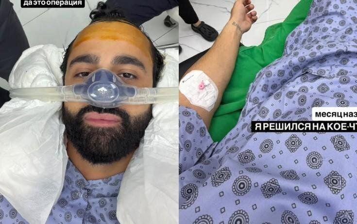 Hüseyn saç əkdirdi -  FOTO