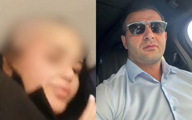 Başı qırxılan qadın danışdı 