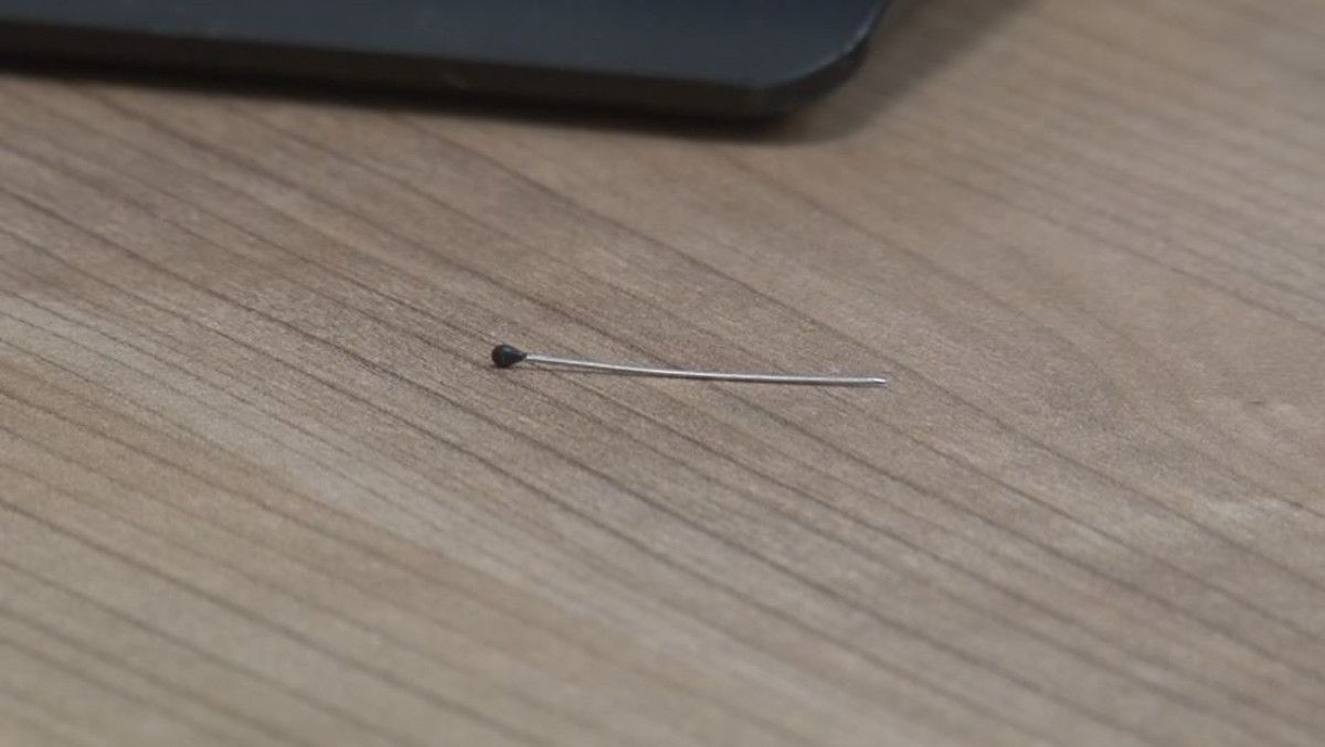 2 yaşlı uşağın bağırsağında iynə tapıldı -  FOTO