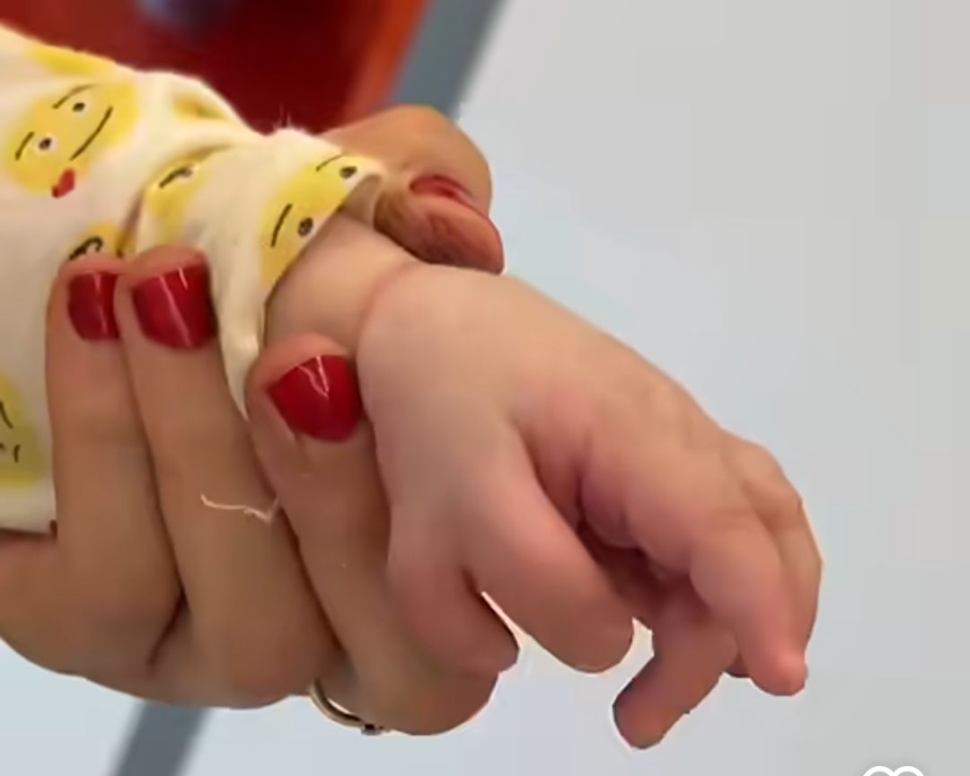 Əldə artıq barmaq nədəndir? -  Həkim açıqladı