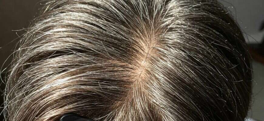 Saçlarımız bizi xərçəngdən qorumaq üçün ağarırmış 