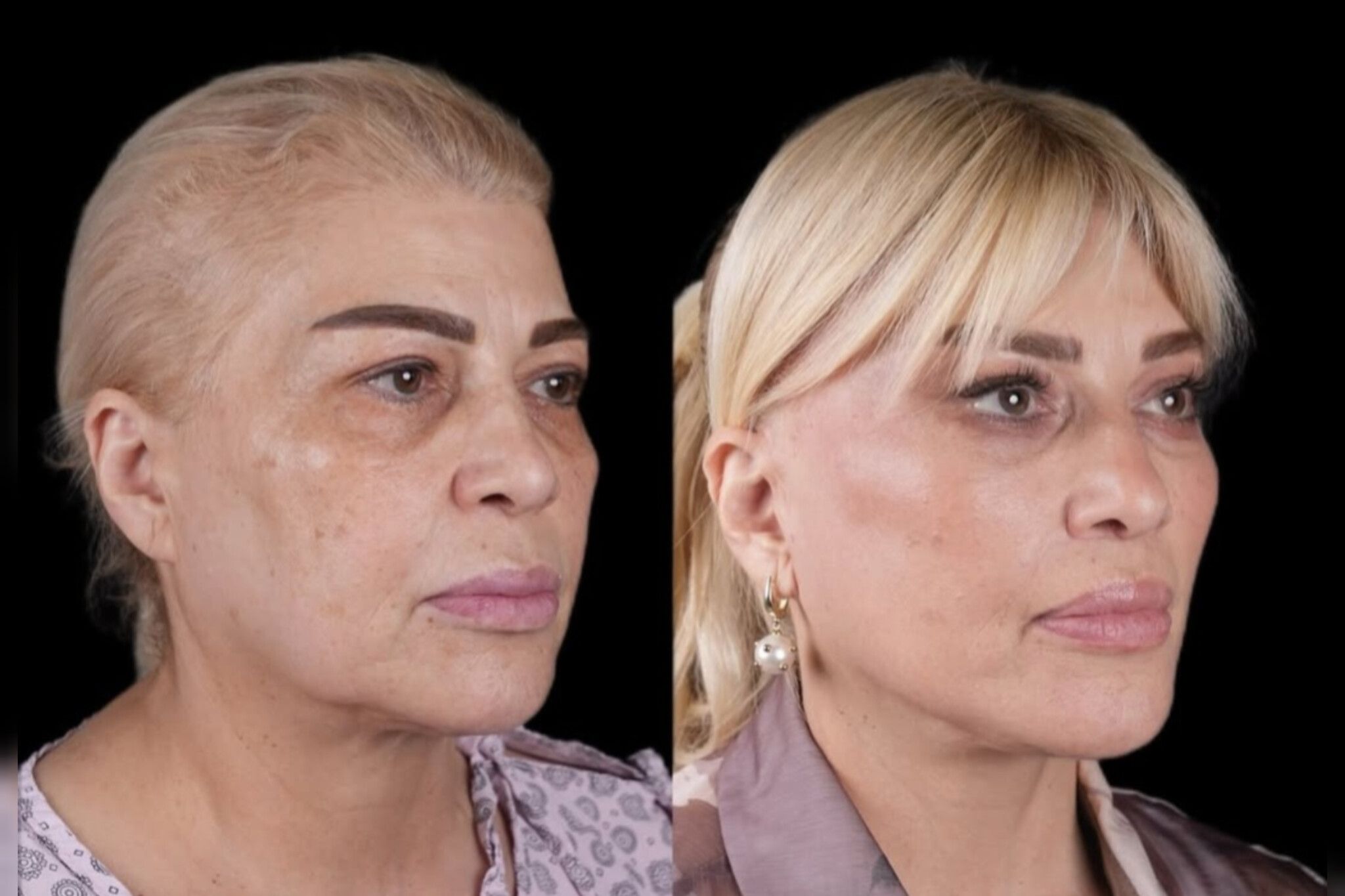 Mətanət İsgəndərlinin dəyişimi gündəm oldu -  FOTO