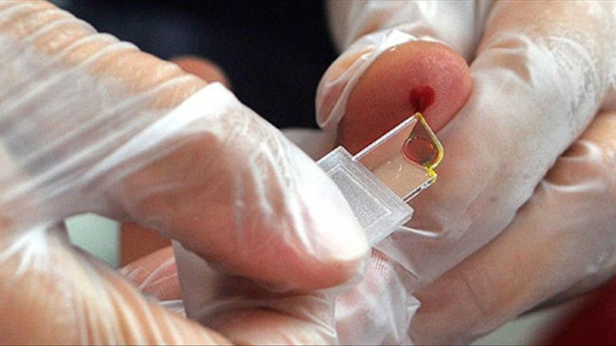 Yeni qan qrupu yaradılır:  Yalnız 50 nəfərdə var