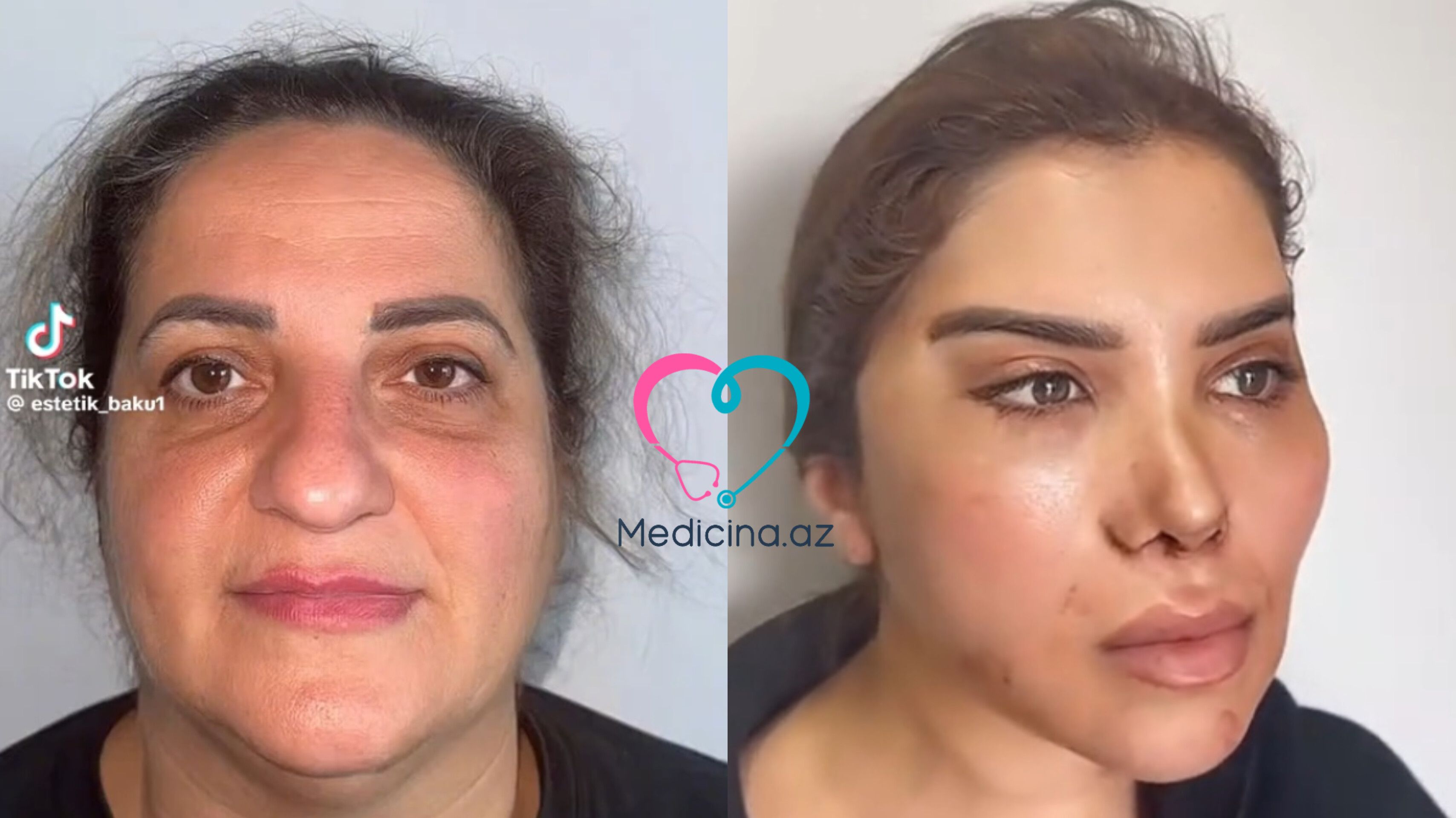 60 yaşlı qadını belə dəyişdilər -  VİDEO