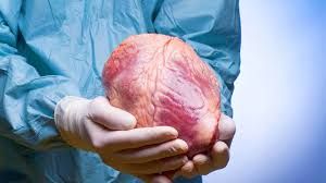 Meyitdən alınan orqan neçə saat yararlıdır? 