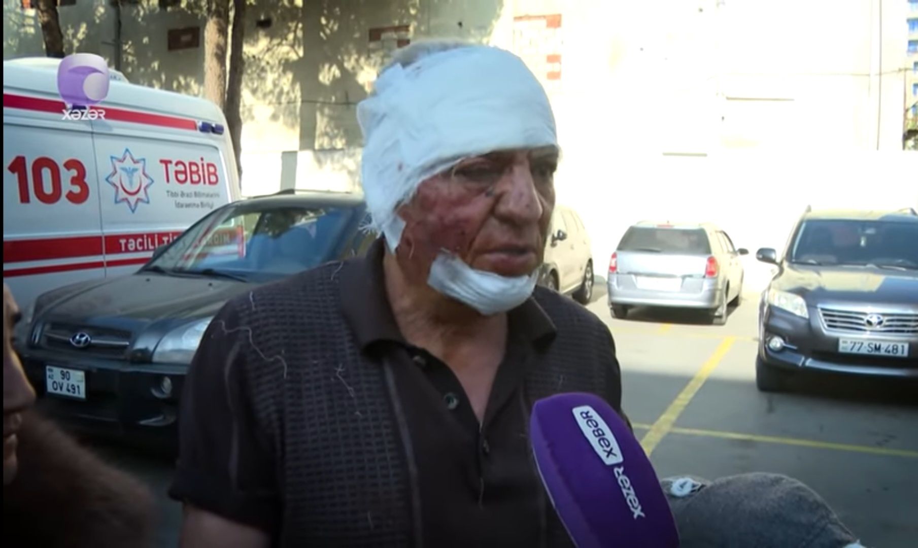 Şüşələr üstümə aşdı, gördüm, hər yerim qandır -  Partlayışda yaralanan şəxs-VİDEO