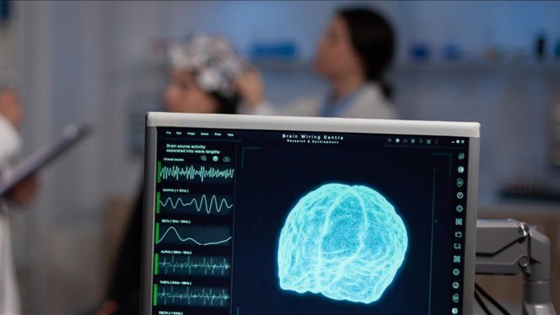 İnsan beyni 32 yaşına qədər yeniyetməlik dövründə qalır -  Araşdırma