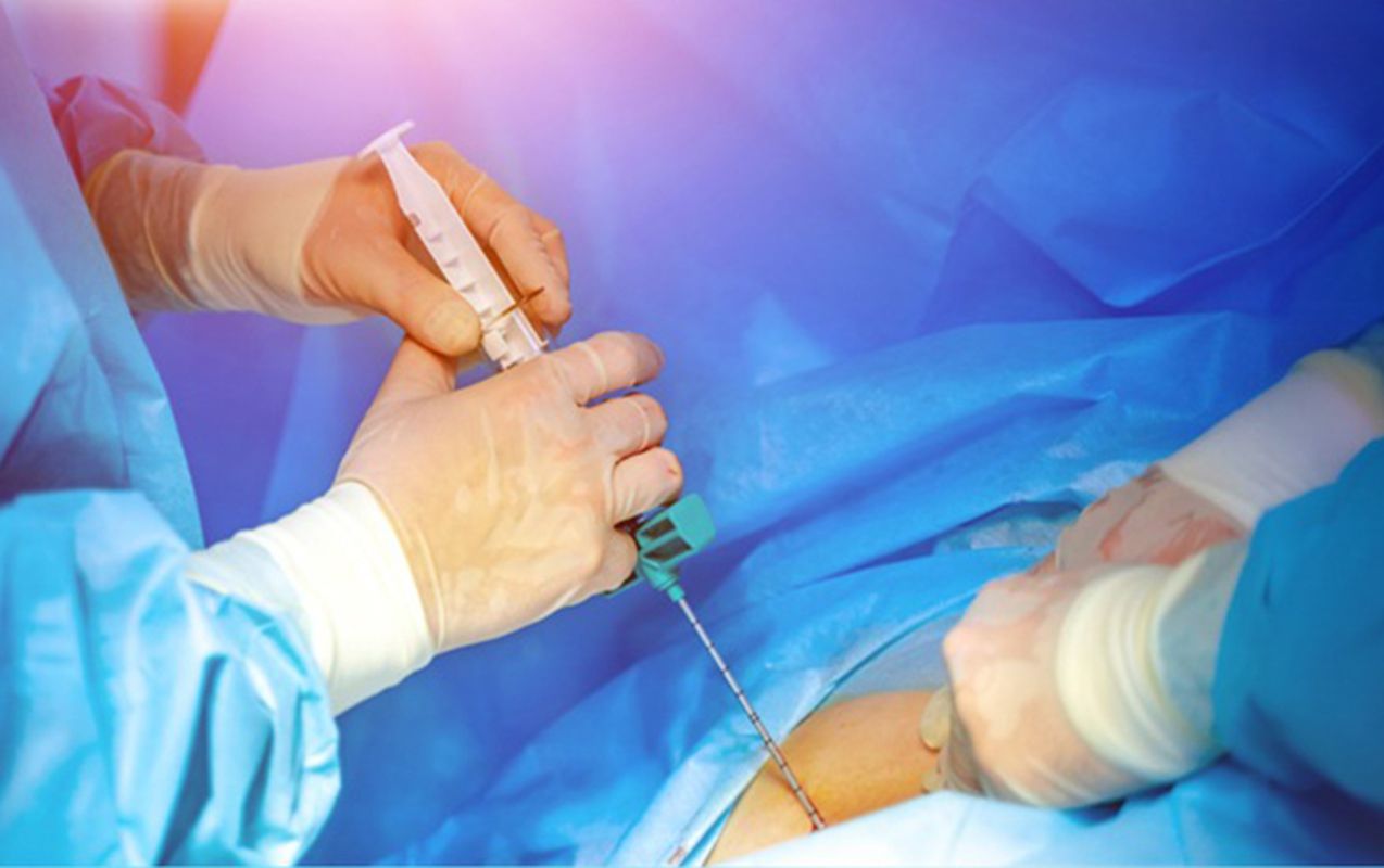 Bu 5 xəstəxanaya sümük iliyi köçürülməsinə    icazə verildi