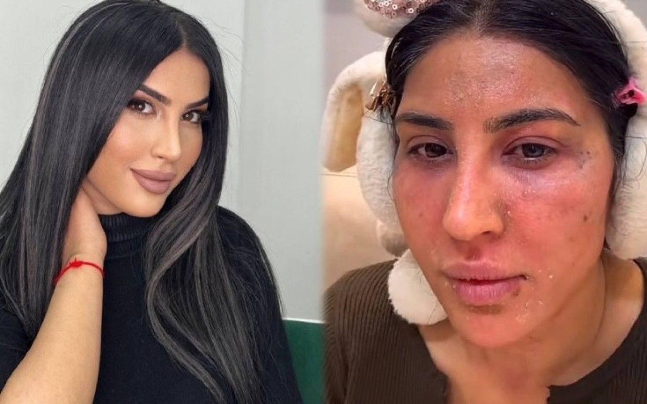 Reklam etdiyi pilinq  Ləmanın üzünü yandırdı