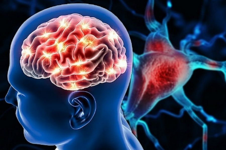  Meteohəssaslığa yozmayın  – Bu əlamət insultdan öncə ola bilər