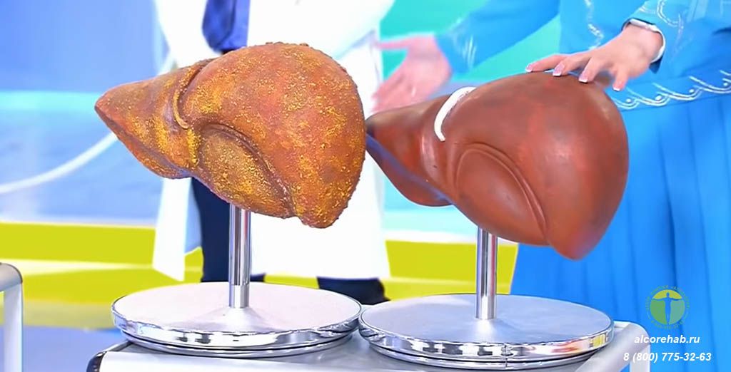 Kimin qaraciyərini araq tez sıradan çıxarır? 