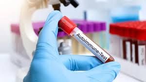 Azərbaycanın ilk autoimmun laboratoriyası  hardadır? 