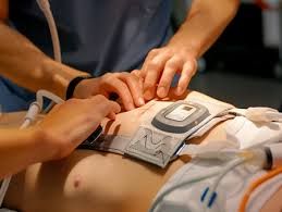 Bayramlarda ürək tutmaları niyə artır? 