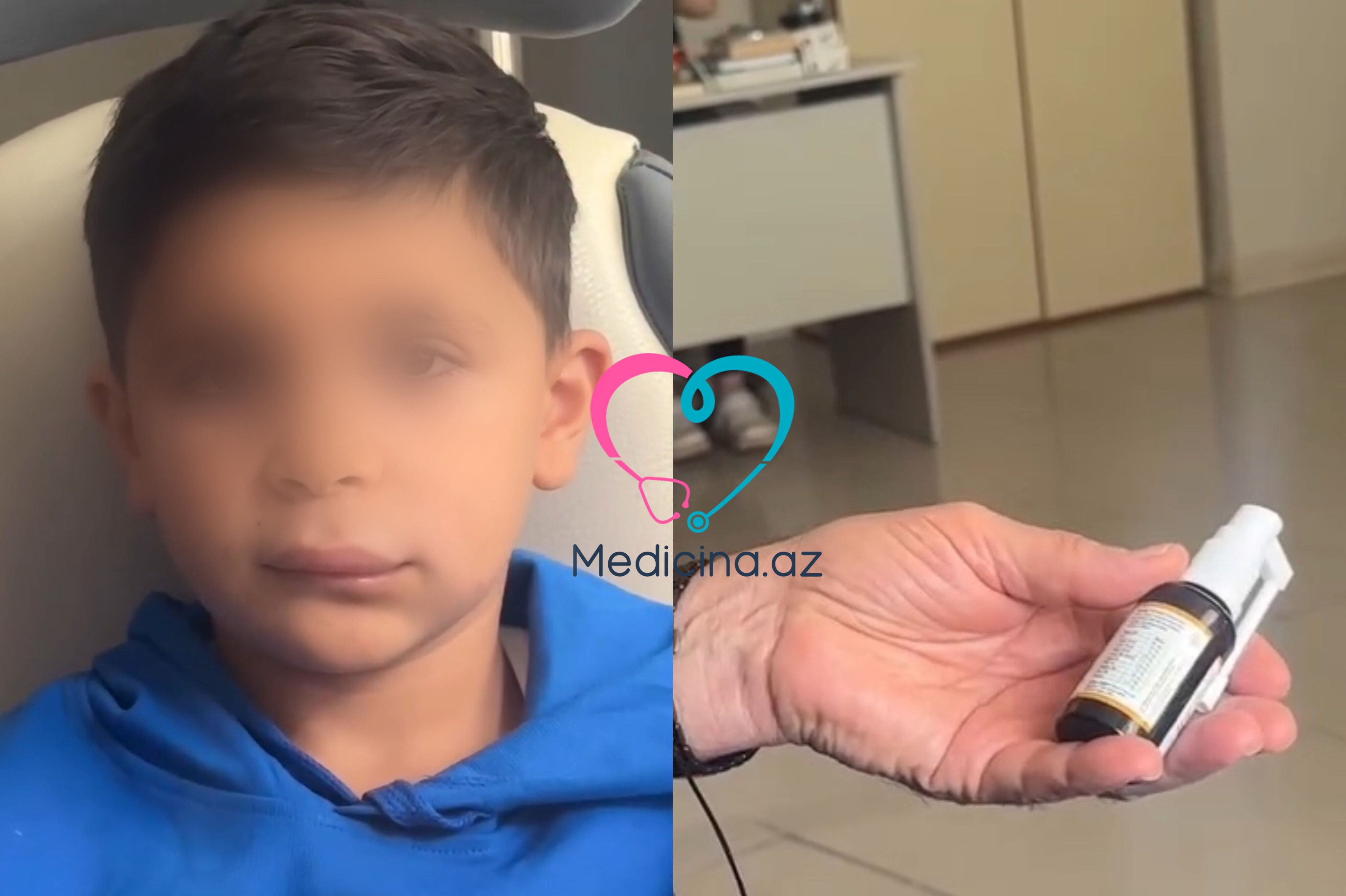 Boğaz spreyindən sonra uşağın üzü  dəhşətli hala düşdü - VİDEO