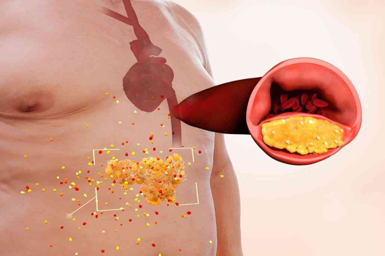  Kimlərdə daxili orqanlar piylənir?  – Diqqət