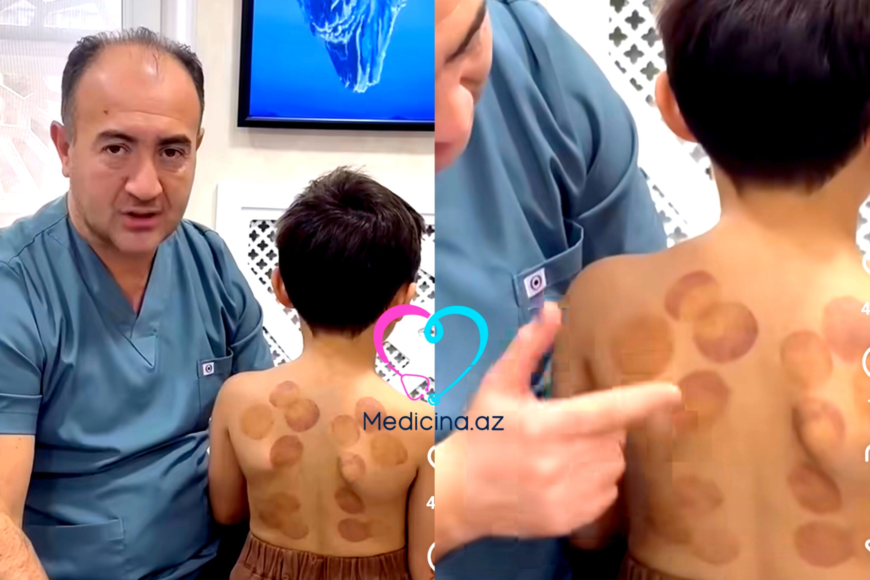 Uşağa neçə yaşında banka qoymaq olar? -  Düzgün qaydalar - VİDEO