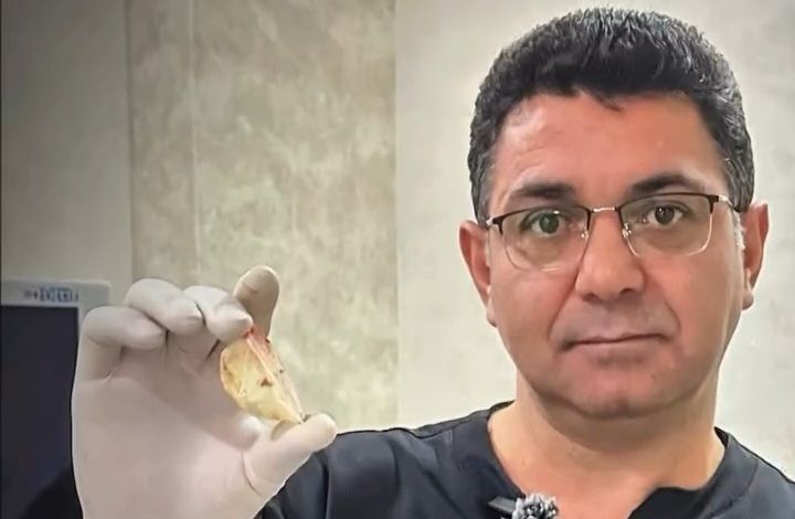 Bakıda xəstə "Rexona" qapağı uddu -  VİDEO