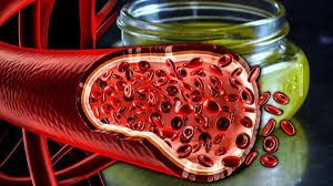 Damarları təmizləmək təhlükəlidir 