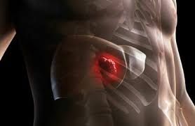  Güclü bel ağrısı qaraciyər xərçəngindən  ola bilər