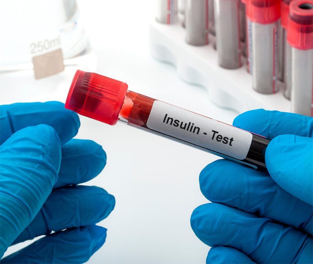 Ürək xəstəliklərinin əsas səbəbi insulin dirəncidir -  Kardioloqdan VİDEO