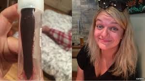 Burnuna zəli girdi, xəbəri olmadı 