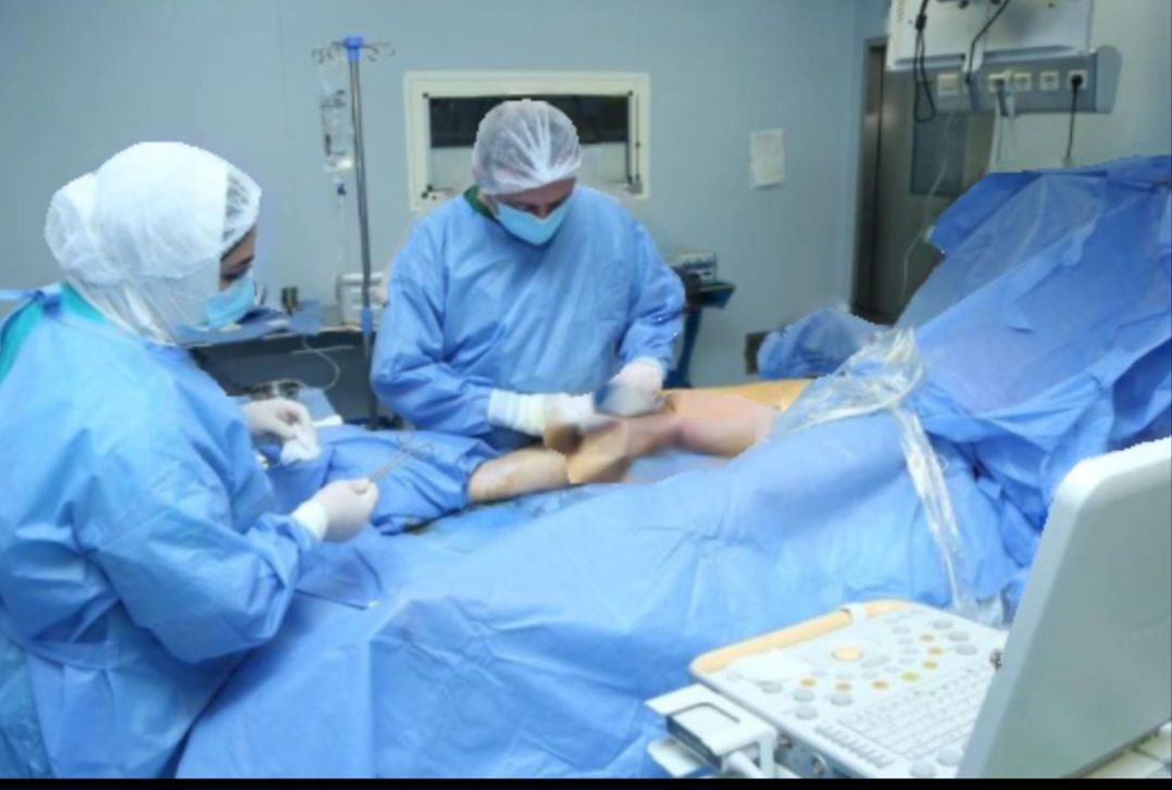 Yeni Klinikada daha bir yenilik -  Varikoz damarlarının lazerlə kəsiksiz müalicəsi