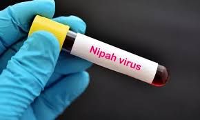  Azərbaycanda Nipah virusuna yoluxma var? 