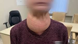 Qadının zobu baş ölçüsünə çatdı 