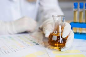 Sidiyin  rənginə  bax   - xəstəliyini tap