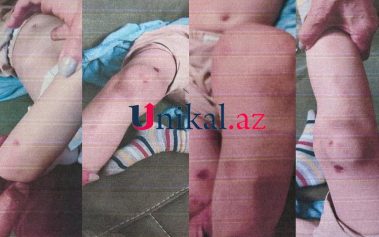 Sevgilisi ilə birlikdə 6 yaşlı oğluna işgəncə edən anaya    - hökm oxundu