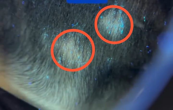 Küçə pişiyi ilə oynayan uşağın saçı töküldü -  Dəri göbələyi yarandı-VİDEO