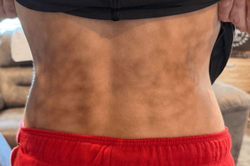 “Qrelkaya” olan sevgisindən bədəni    bu hala düşdü