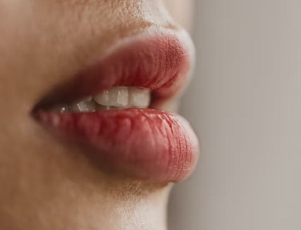 Dodaqlar çatlayırsa  – autoimmun xəstəlikdən yoxlan 