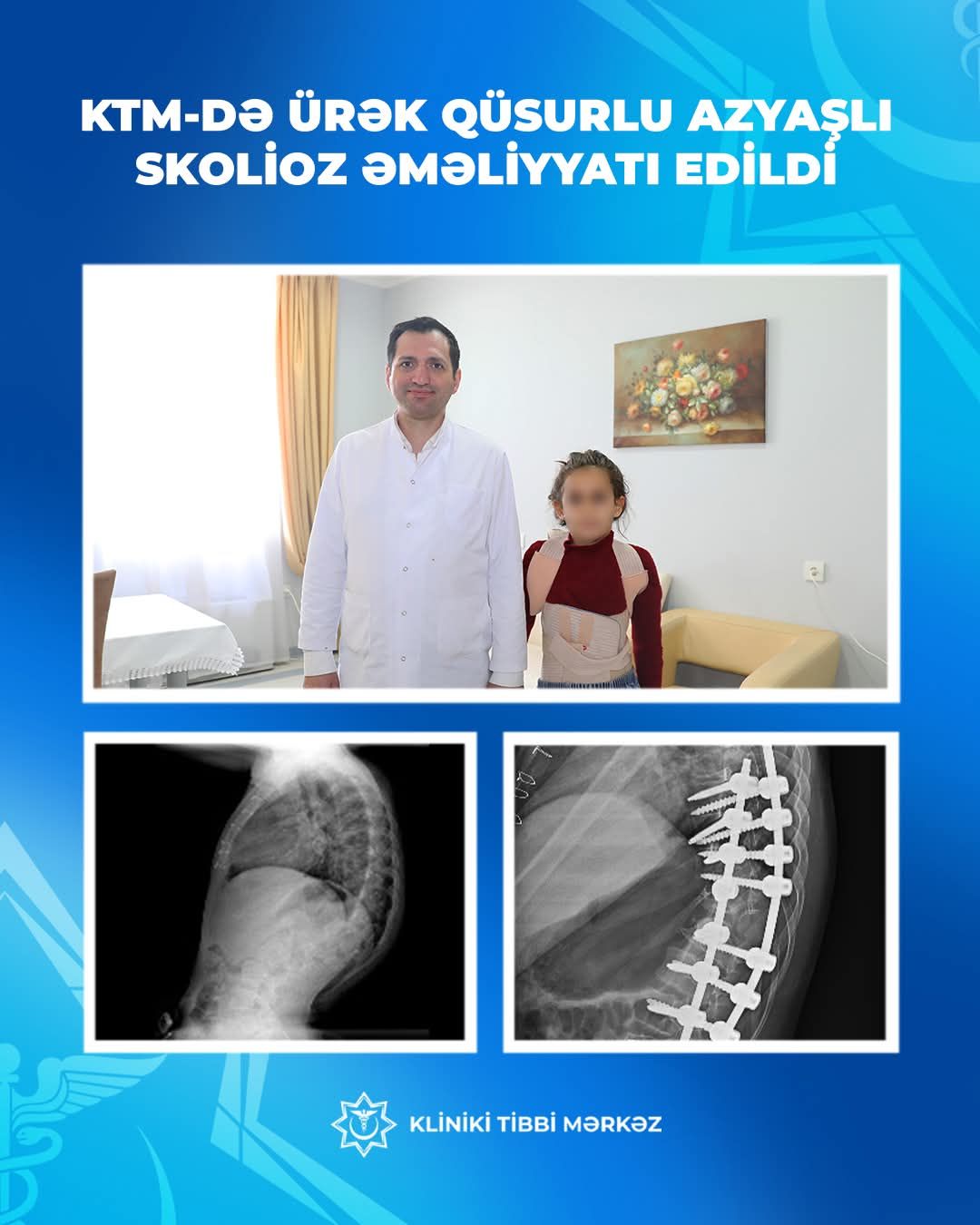 Ürək qüsuru var idi,  sağlam gəzəcək