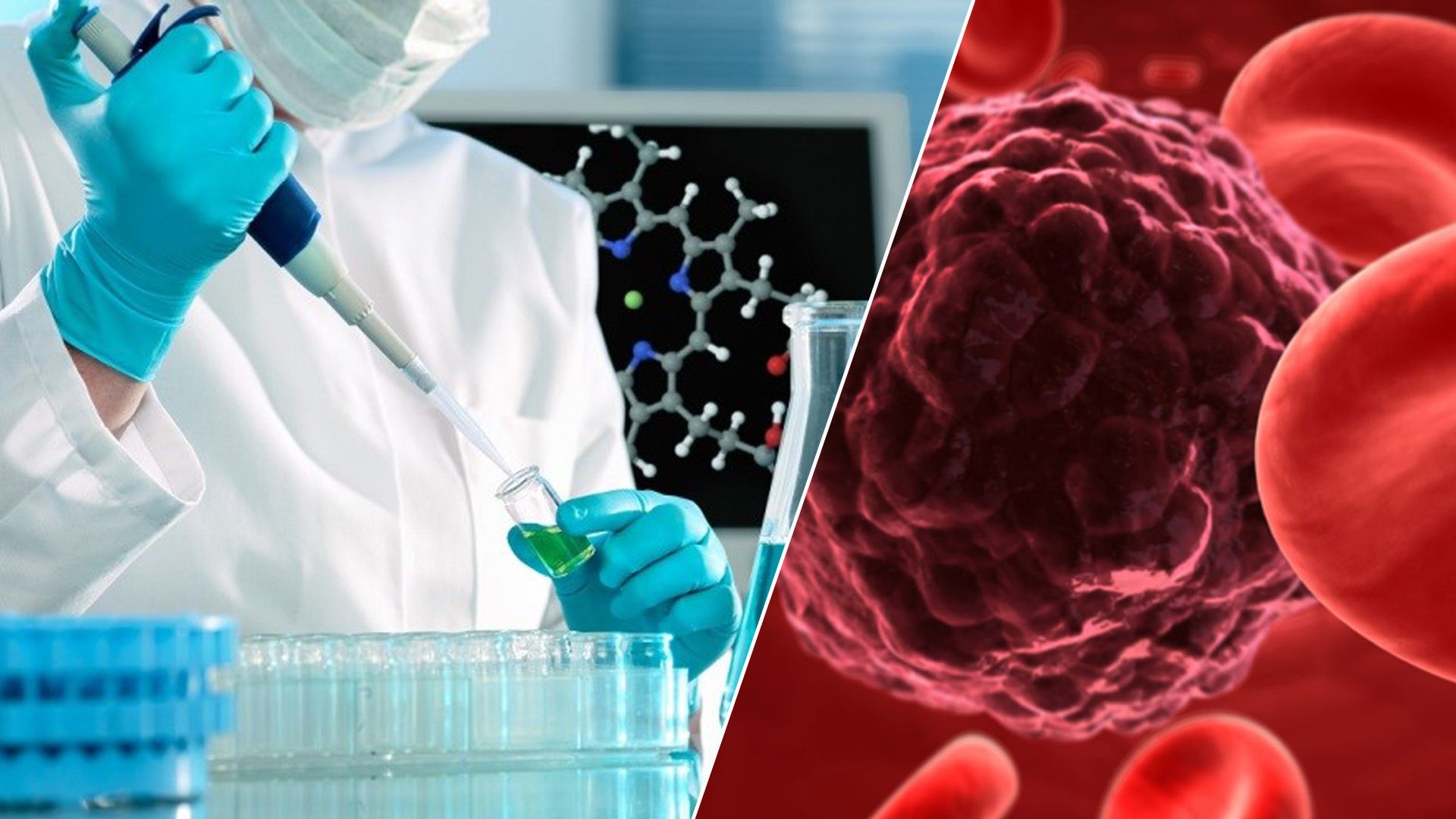 Xərçəng müalicəsində yeni  araşdırma