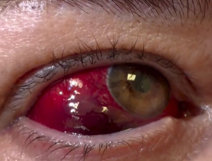 Qadının gözü zədələndi -  Dəhşətli hala düşdü - VİDEO