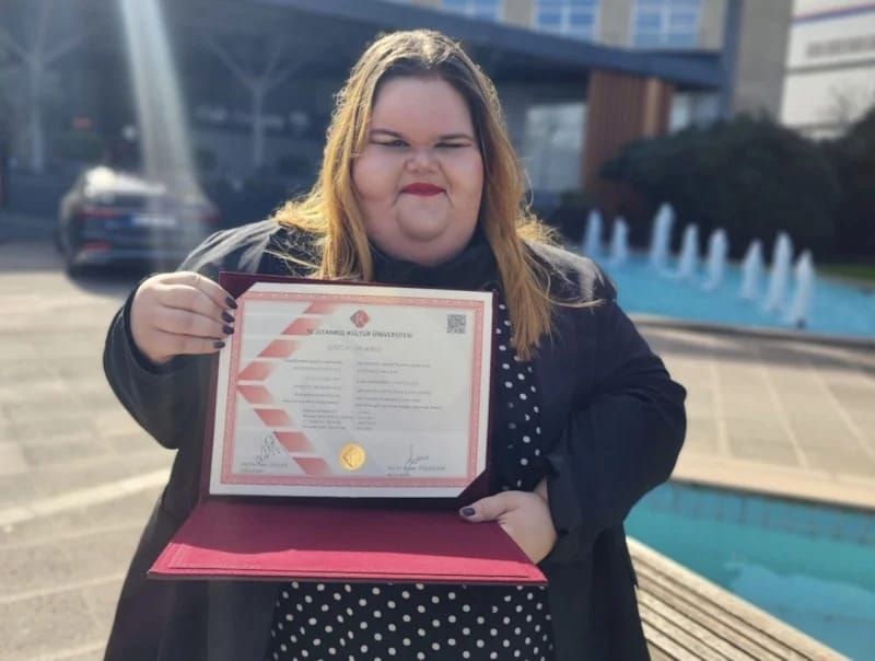 Çəkisinə görə lağa qoyulurdu,  amma təslim olmadı-FOTO